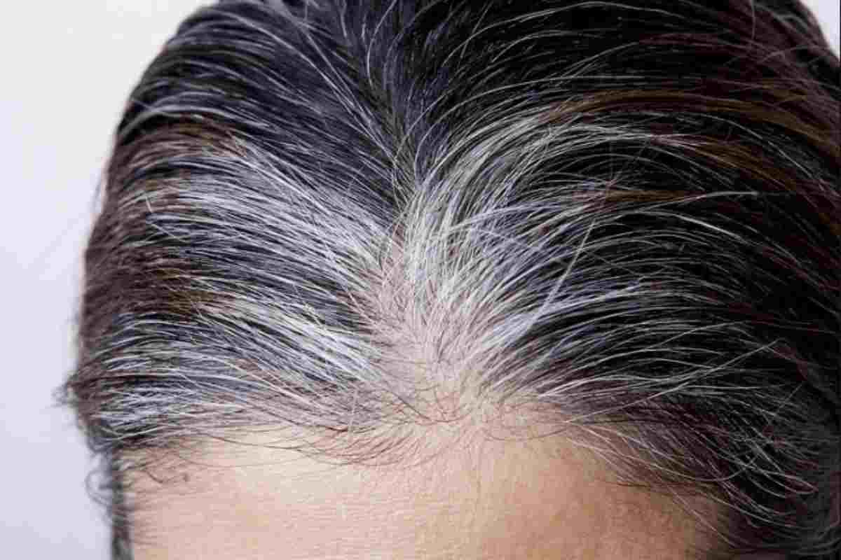 Capelli bianchi, rimedi naturali