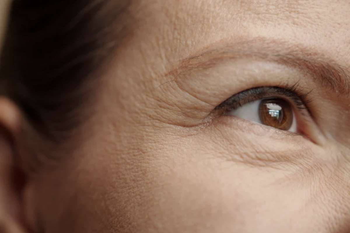 Tra queste, il contatto notturno con la federa del cuscino gioca un ruolo fondamentale nel determinare la formazione delle cosiddette